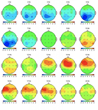 Brain map from a neurofeedback device